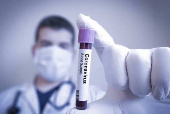 В Арцахе подтверждено 6 новых случаев заражения COVID-19