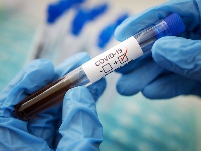 В Армении за сутки зарегистрировано 195 новых случаев заражения коронавирусом