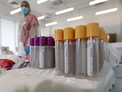 В Армении за сутки зарегистрирован 71 новый случай заражения коронавирусом