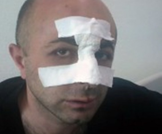 Հայկ Խանումյանը տուժող է ճանաչվել